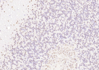 KLHL7 Rabbit Polyclonal Antibody