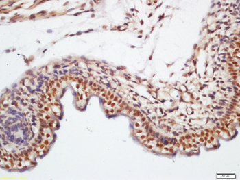 KLHL7 Rabbit Polyclonal Antibody