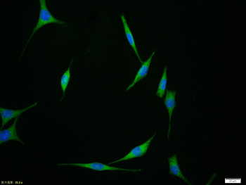 APAF1 (CT) Rabbit Polyclonal Antibody
