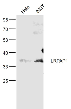 LRPAP1 Rabbit Polyclonal Antibody