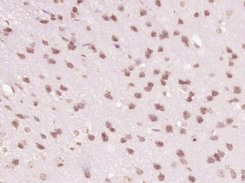 TCF3 Rabbit Polyclonal Antibody