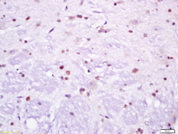 TCF3 Rabbit Polyclonal Antibody