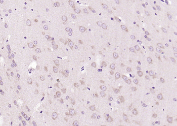 APAF1 (NT) Rabbit Polyclonal Antibody