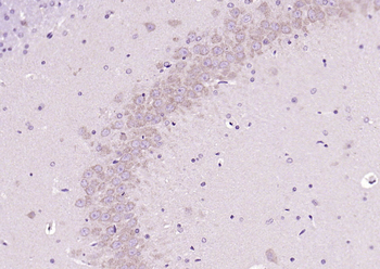 APAF1 (NT) Rabbit Polyclonal Antibody
