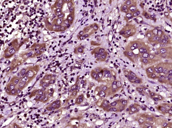 RND3 Rabbit Polyclonal Antibody