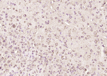 TP53I13 Rabbit Polyclonal Antibody