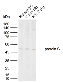 Protein C Rabbit Polyclonal Antibody