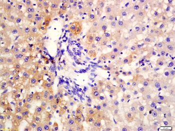 Protein C Rabbit Polyclonal Antibody