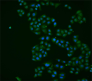 APEX1 Rabbit Polyclonal Antibody