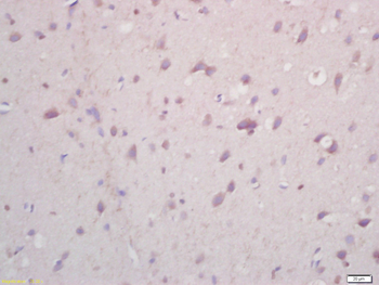 ALOX15 Rabbit Polyclonal Antibody