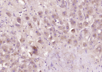 SERPINC1 Rabbit Polyclonal Antibody