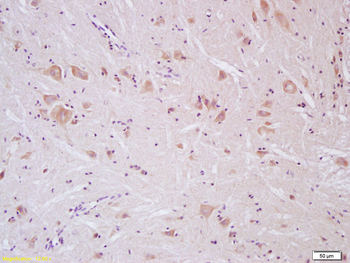 SCN10A/Nav1.8 Rabbit Polyclonal Antibody