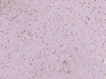 ADM2 Rabbit Polyclonal Antibody