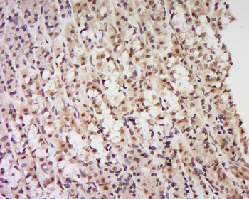 KLHL20 Rabbit Polyclonal Antibody