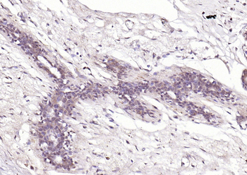 TNMD Rabbit Polyclonal Antibody