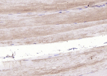 TNMD Rabbit Polyclonal Antibody