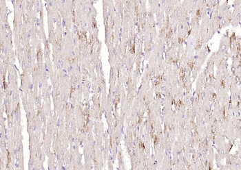 TNMD Rabbit Polyclonal Antibody