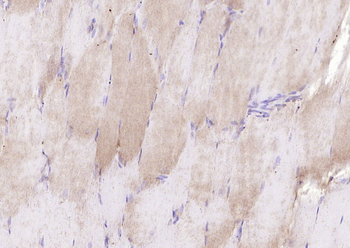 TNMD Rabbit Polyclonal Antibody