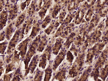 TNMD Rabbit Polyclonal Antibody