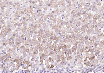 FTO Rabbit Polyclonal Antibody