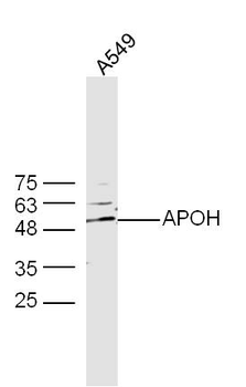 APOH Rabbit Polyclonal Antibody