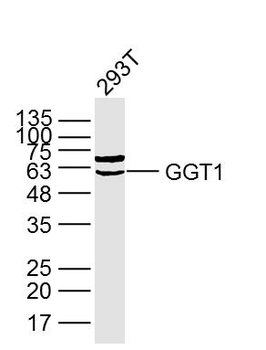 GGT1 Rabbit Polyclonal Antibody