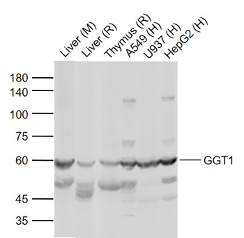 GGT1 Rabbit Polyclonal Antibody