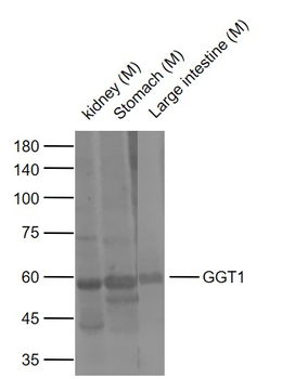 GGT1 Rabbit Polyclonal Antibody