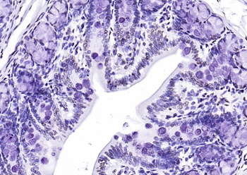 CIDEC Rabbit Polyclonal Antibody