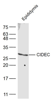 CIDEC Rabbit Polyclonal Antibody
