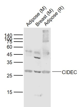 CIDEC Rabbit Polyclonal Antibody