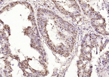 CIDEC Rabbit Polyclonal Antibody