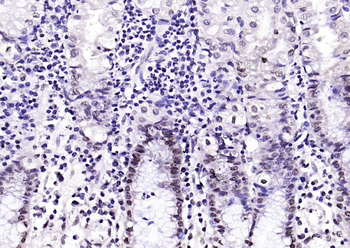 CIDEC Rabbit Polyclonal Antibody