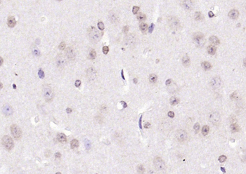 CIDEC Rabbit Polyclonal Antibody