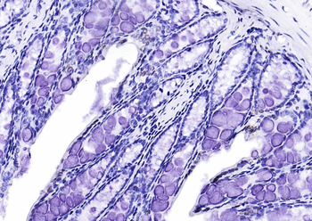 CIDEC Rabbit Polyclonal Antibody