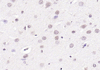 CIDEC Rabbit Polyclonal Antibody