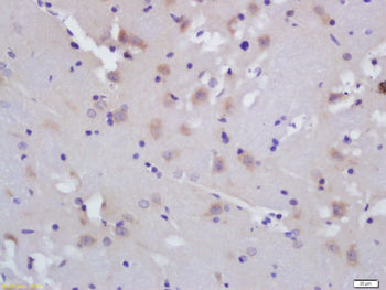 ALOX5AP Rabbit Polyclonal Antibody