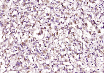 BIRC6 Rabbit Polyclonal Antibody