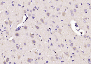 FIS1 Rabbit Polyclonal Antibody