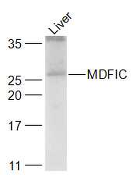 MDFIC Rabbit Polyclonal Antibody