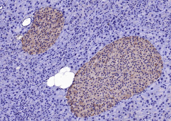 EIF4B Rabbit Polyclonal Antibody