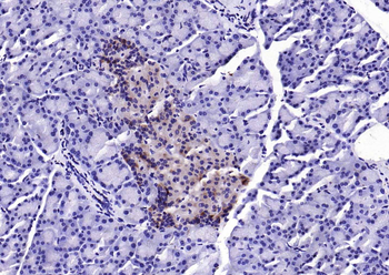 EIF4B Rabbit Polyclonal Antibody