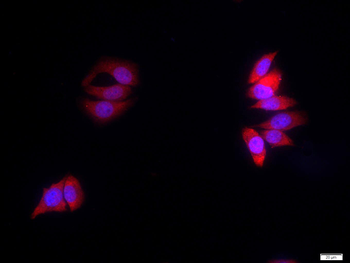 Amyloid Precursor Protein Rabbit Polyclonal Antibody