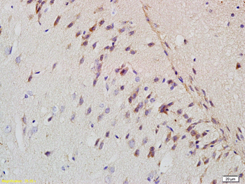Amyloid Precursor Protein Rabbit Polyclonal Antibody