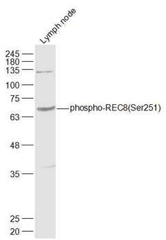 Phospho-REC8 (Ser251) Rabbit Polyclonal Antibody