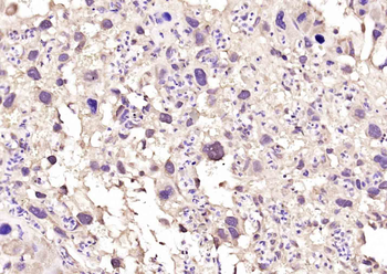 RACGAP1 Rabbit Polyclonal Antibody