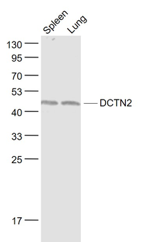 DCTN2 Rabbit Polyclonal Antibody