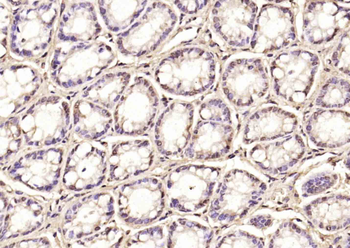MNAT1 Rabbit Polyclonal Antibody