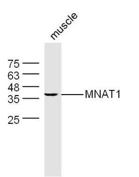 MNAT1 Rabbit Polyclonal Antibody
