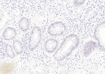 APPL1 Rabbit Polyclonal Antibody